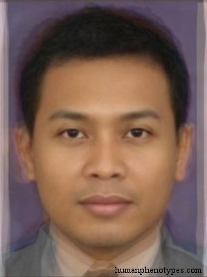 http://humanphenotypes.net/deuteromalayidm.jpg