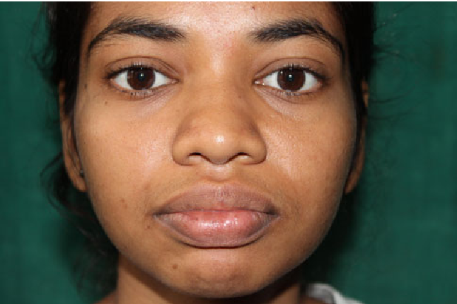 The Average Indian Female Nose | Semantic Scholar