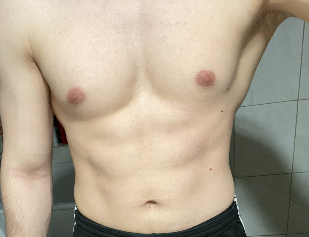 postimg.cc