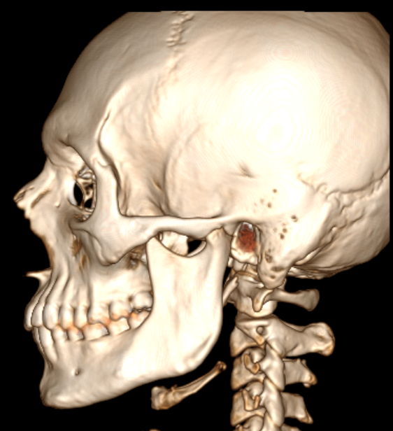 6815268_scan2.png
