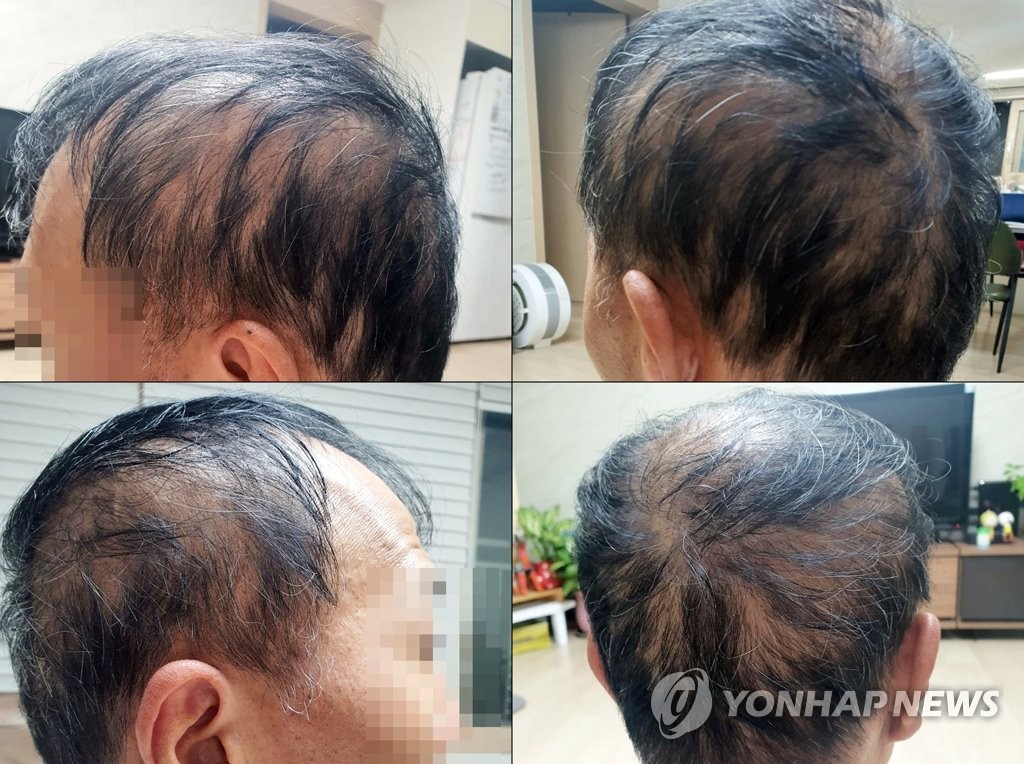 en.yna.co.kr