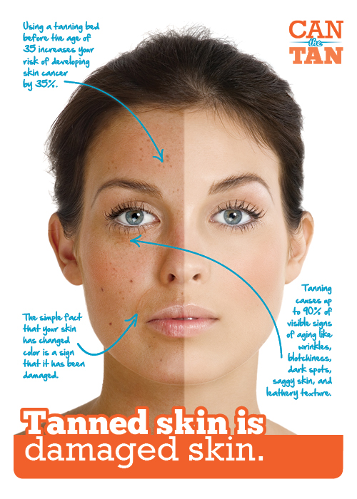 skin-cancer-detection.jpg
