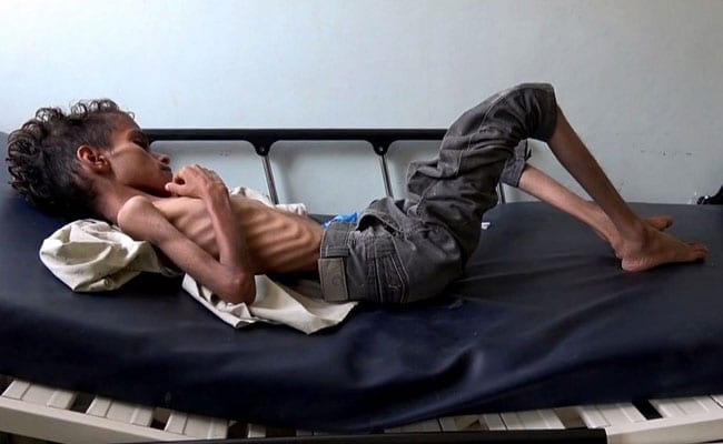 jlpvmshg_yemen-war-afp_625x300_21_November_18.jpg