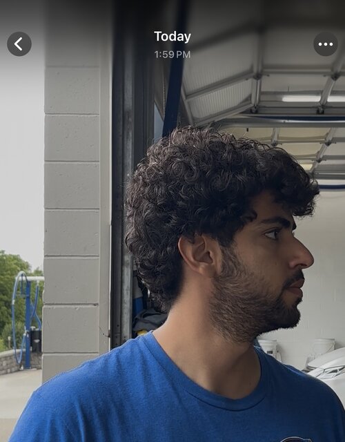 As you can see here my face looks fucking small compared to my skull/head so I’m not fucking sure what to tackle here 