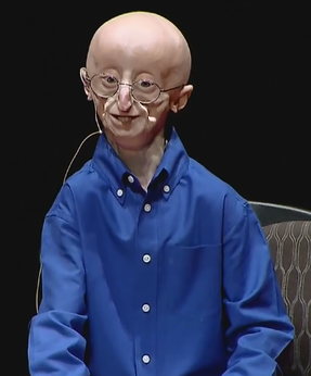 Sam_Berns_at_TEDx_Talks_2013.png