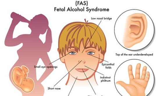 123-FAS-alc-zw-170-10.jpg