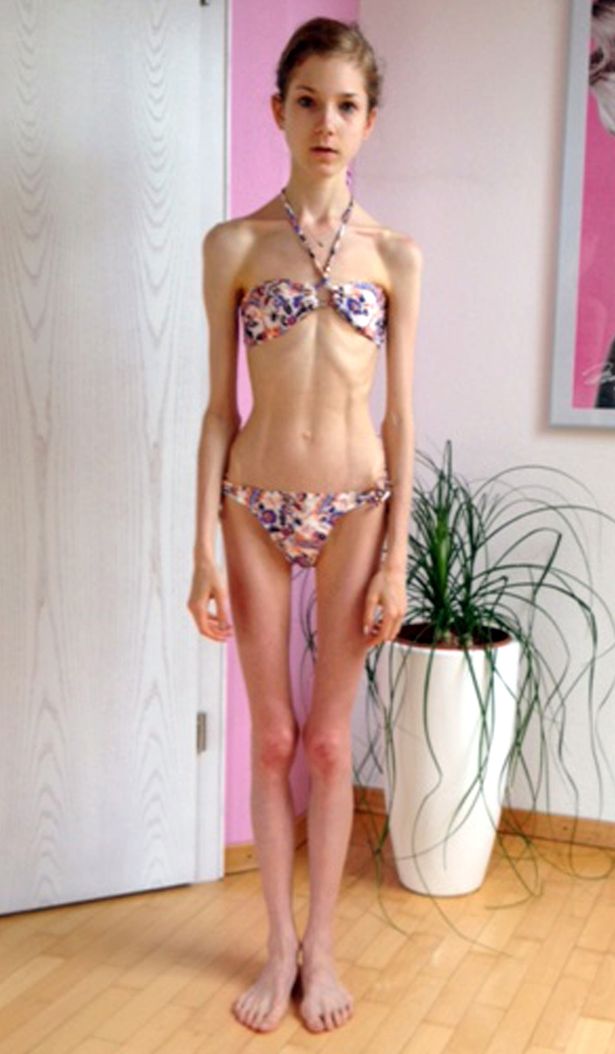 PAY-3-STONE-ANOREXIC.jpg