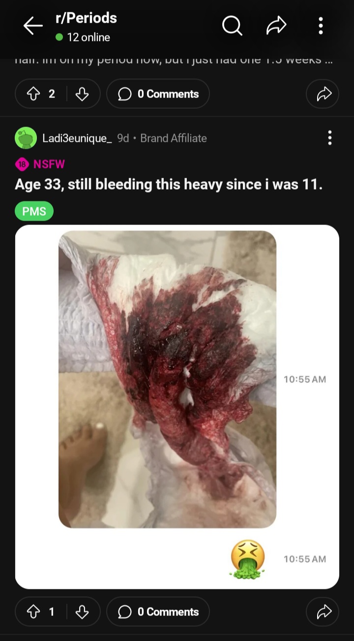 Screenshot 20240504 094136 Reddit