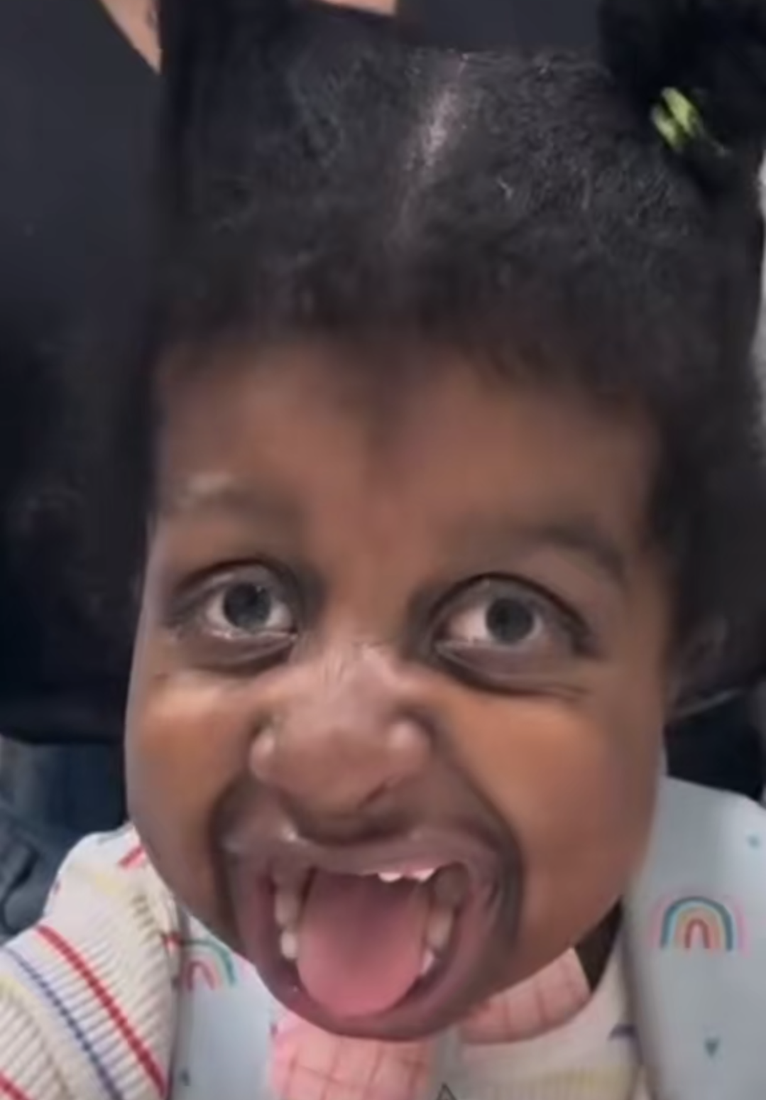 1000015035