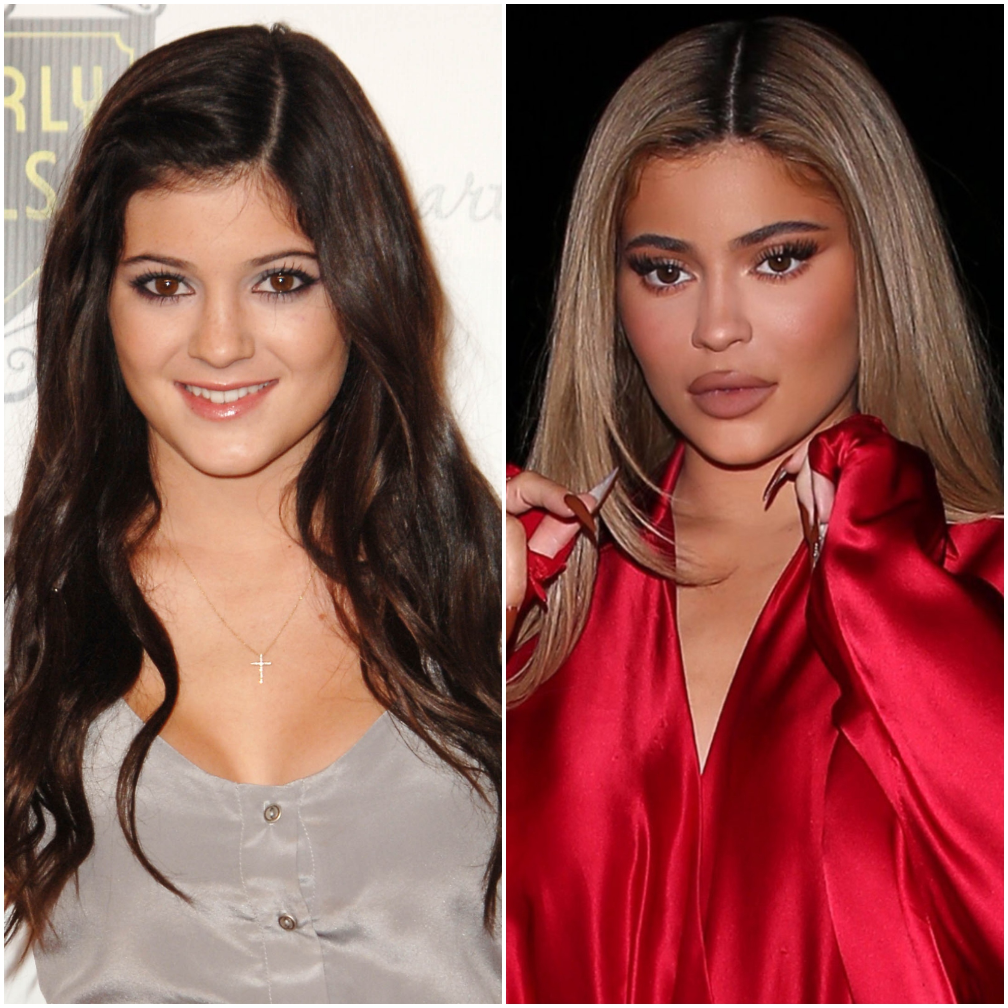 Kylie-Jenner-Plastic-Surgery.jpg