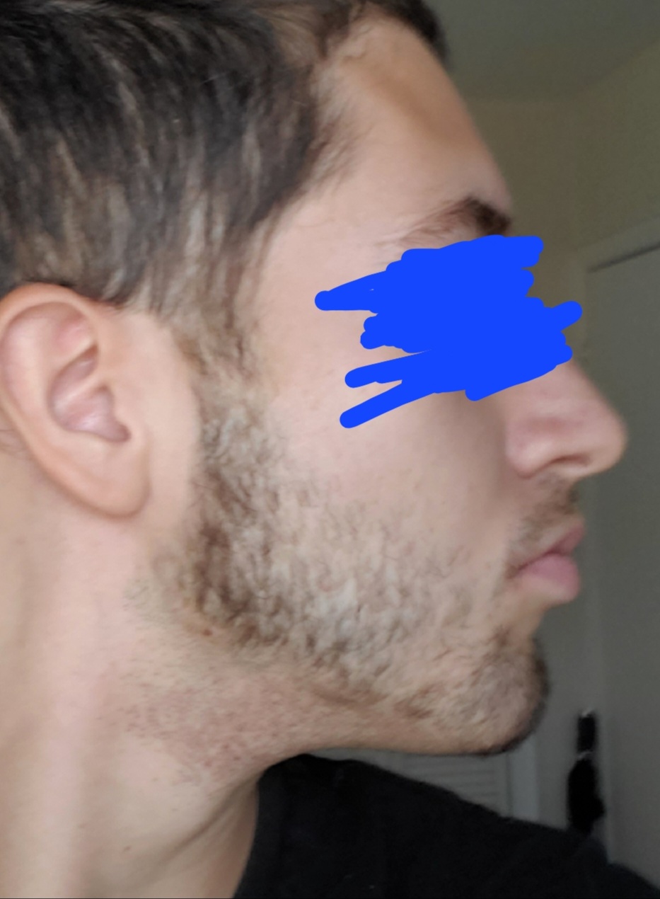 3308662_23es.jpg