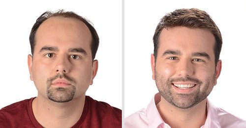 mobile-before-after-xp-justin-767x400-500x500.jpg