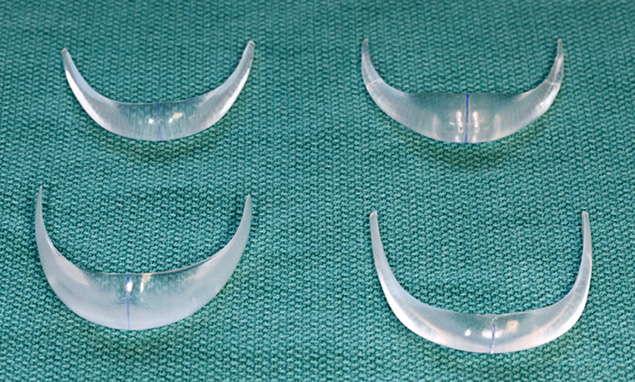 chin-implant-shape-variety-frontal-small.jpg
