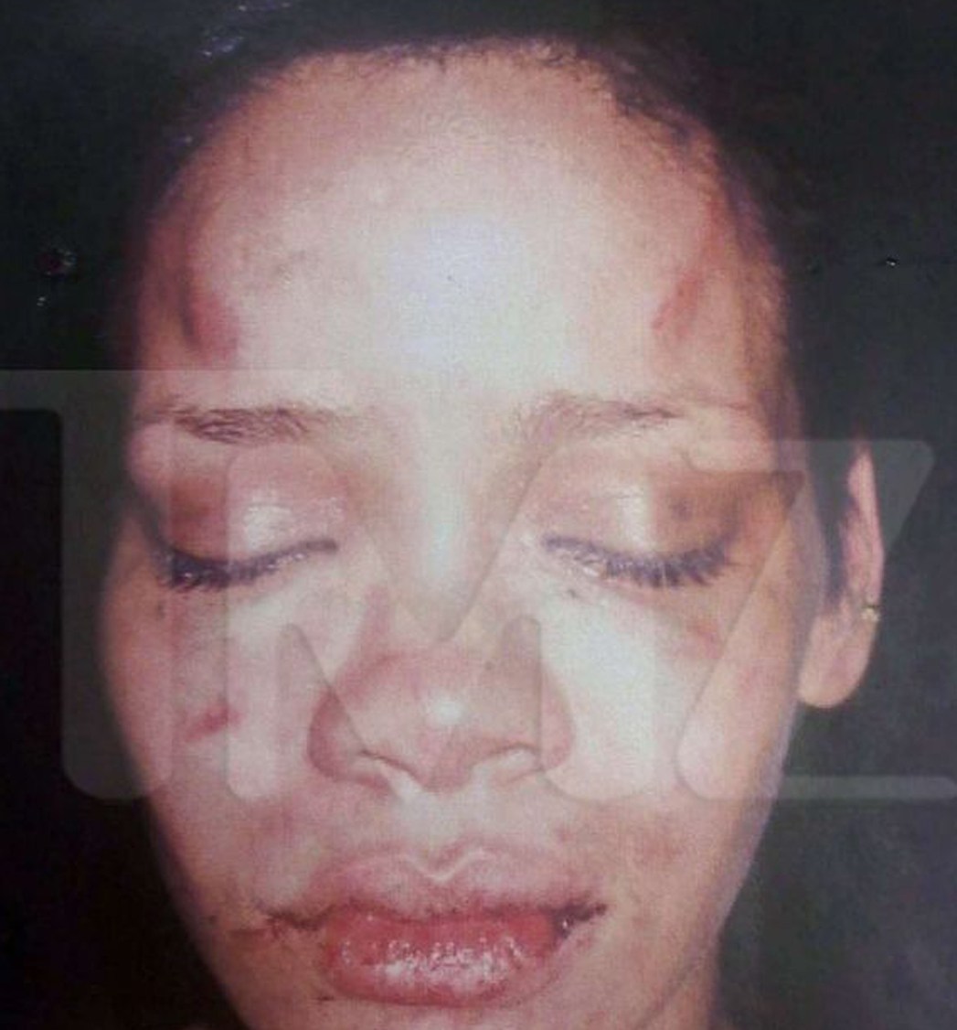 leaked_rihanna_lapd_photo.jpg