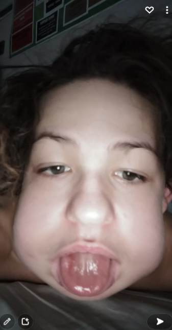 2681230_surgeryrecover.jpg