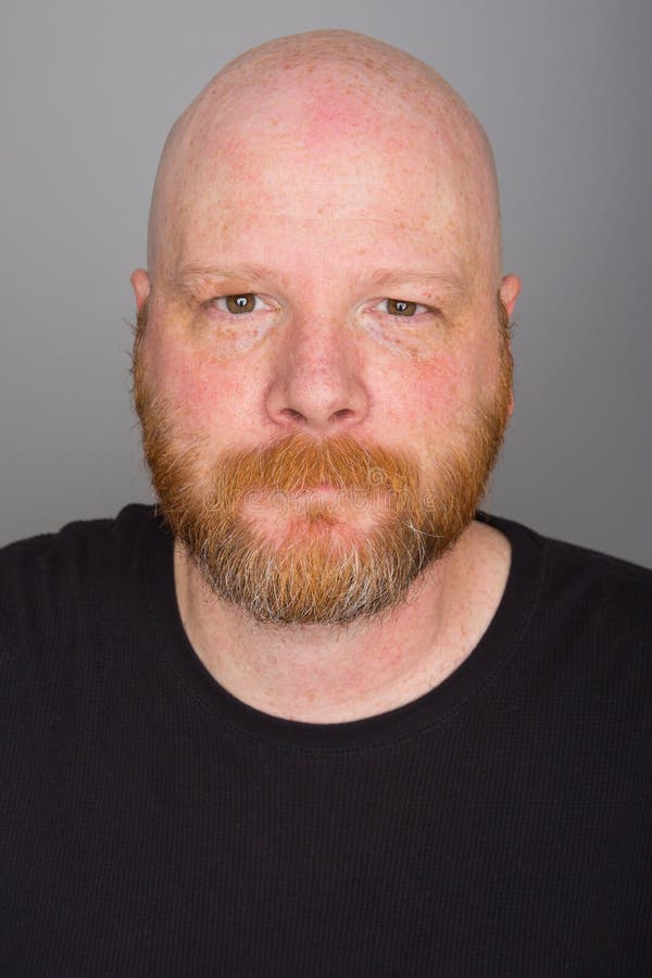bald-man-beard-ginger-freckles-47605531.jpg