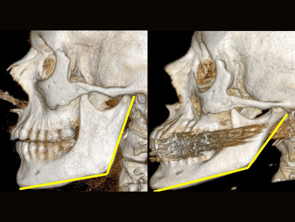 skullcomp-674ed2578f81ae35a1da75798399c2e81e4a152a.jpg