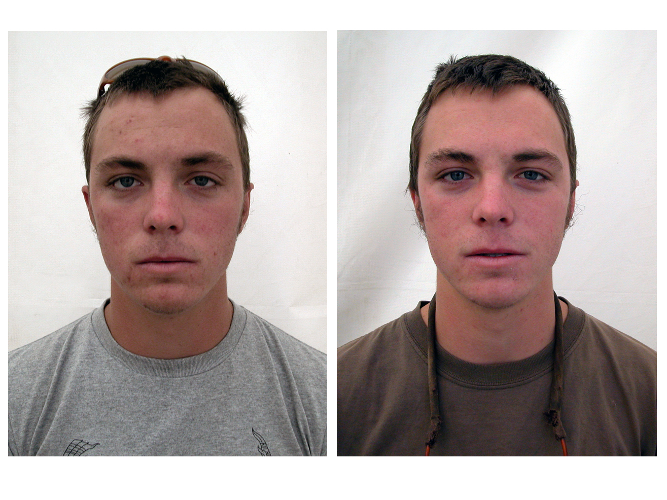 08beforeafterF.jpg