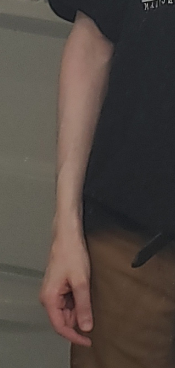 vRZbzZq.png