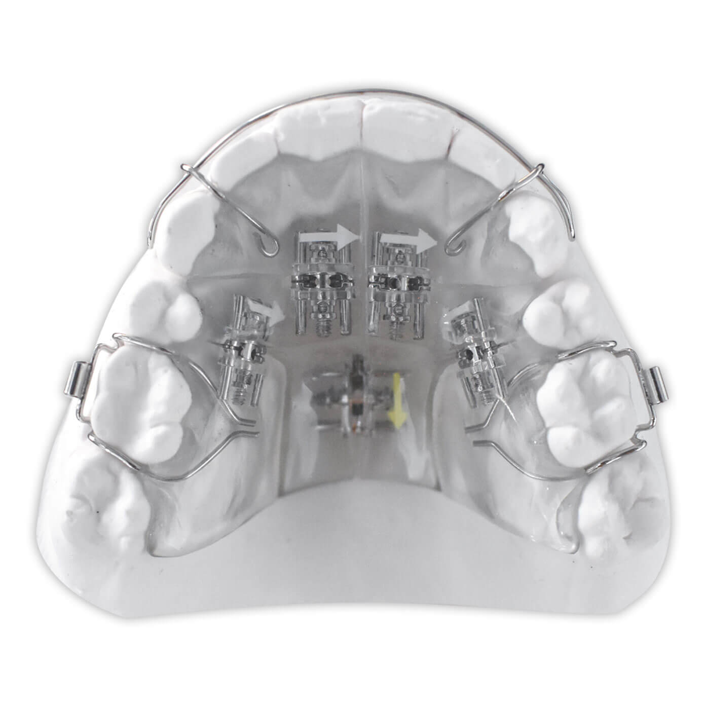 www.bracesshop.com