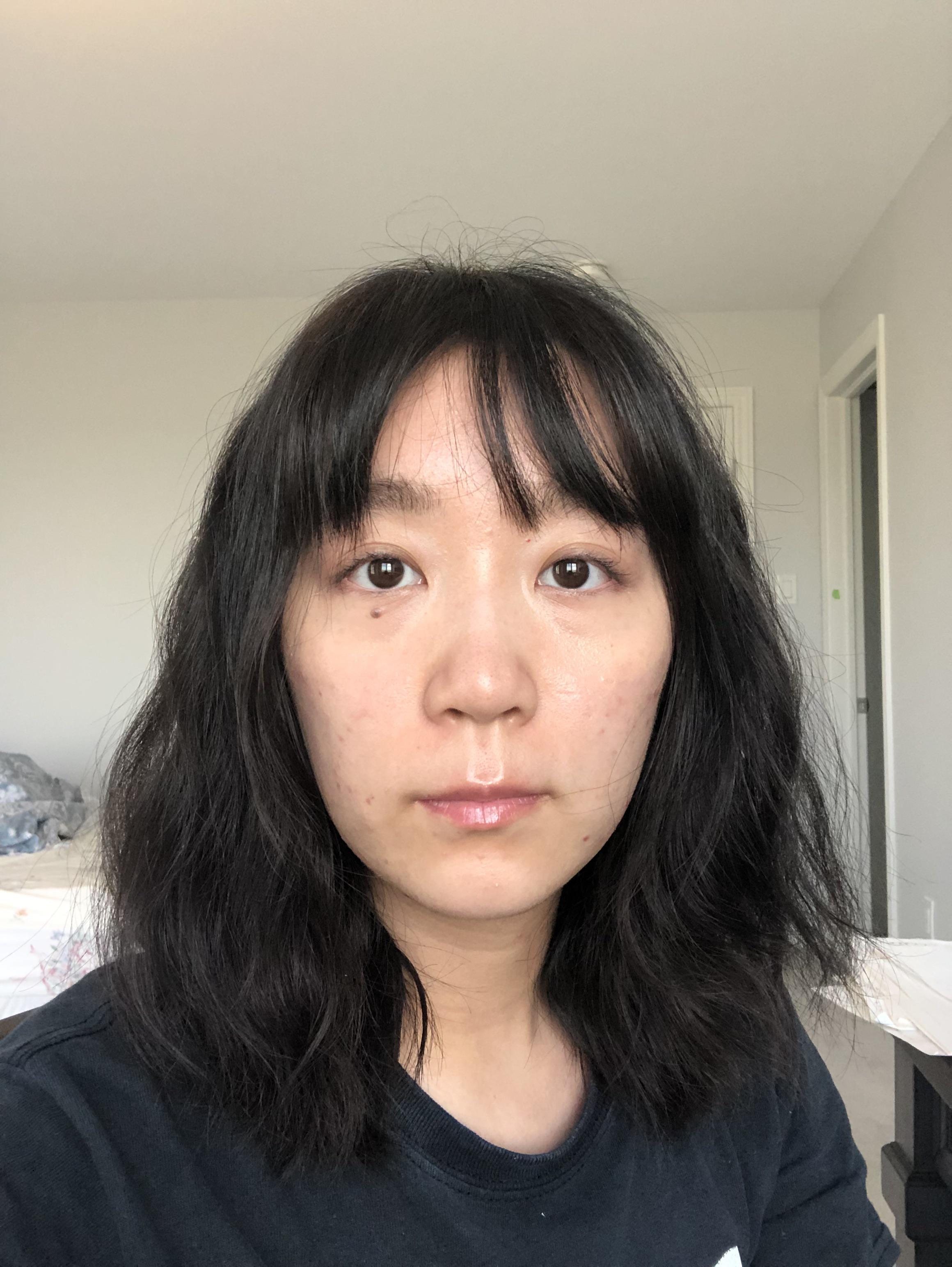 I'm only 21 but look 35!! I think it's a combination of eye bags and a long  philtrum that make me look far older than I am. However my eyes naturally  protrude