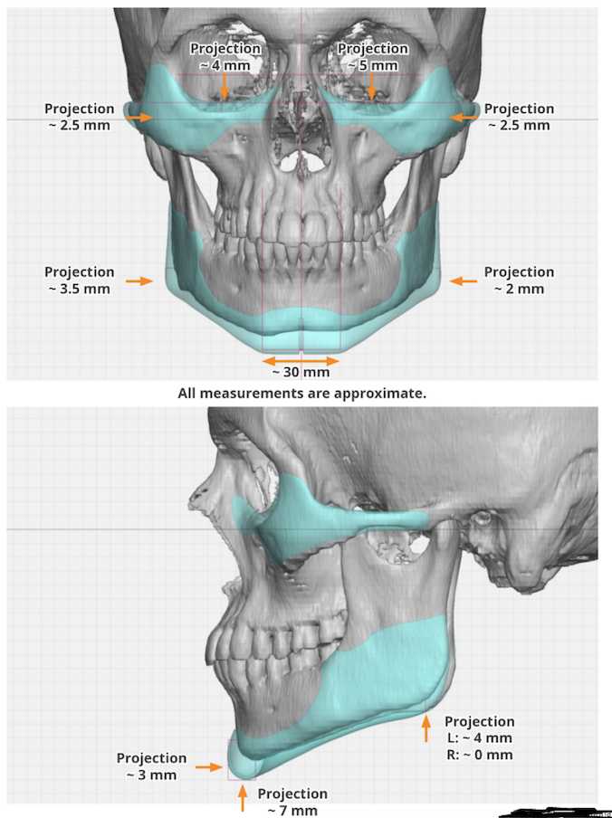 85ed5c1d89157fa22b215830df5d6678.png