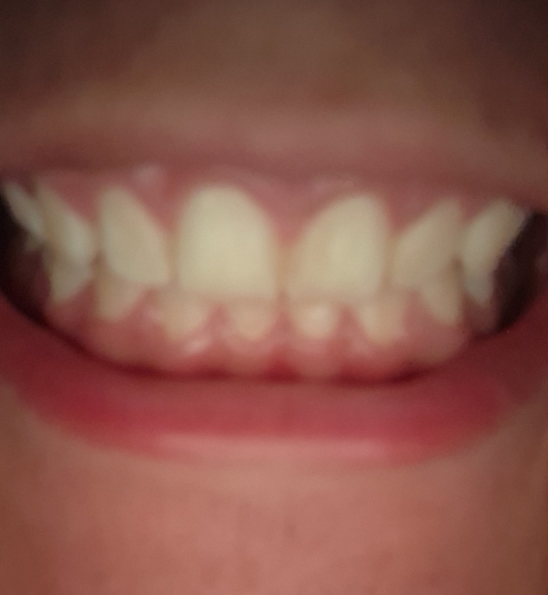 4690