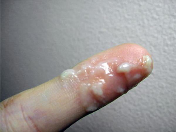cervical-mucus-sticky_4x3.jpg
