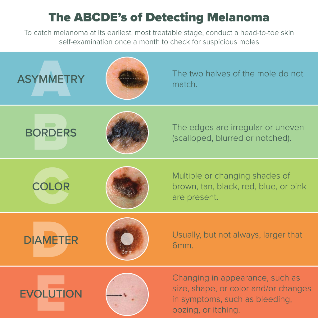 Melanoma-Infographic-copy.png