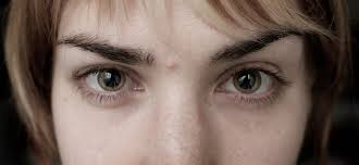 Image result for dilated pupils