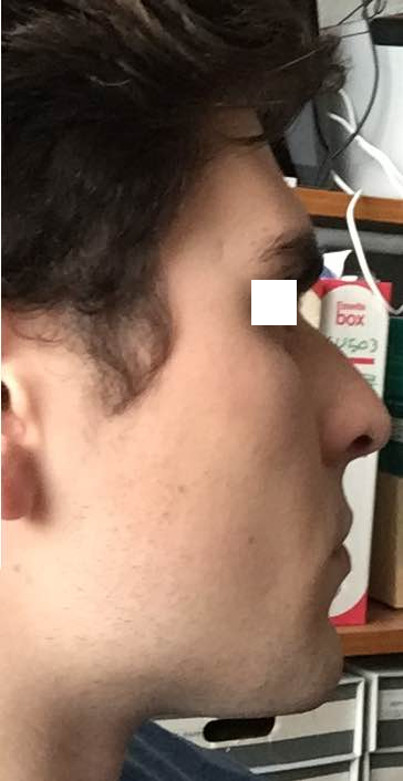 2893450_pro.png