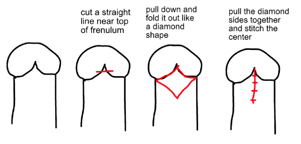 Img_circum-2.png