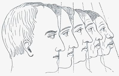 8471common-facial-angle.jpg
