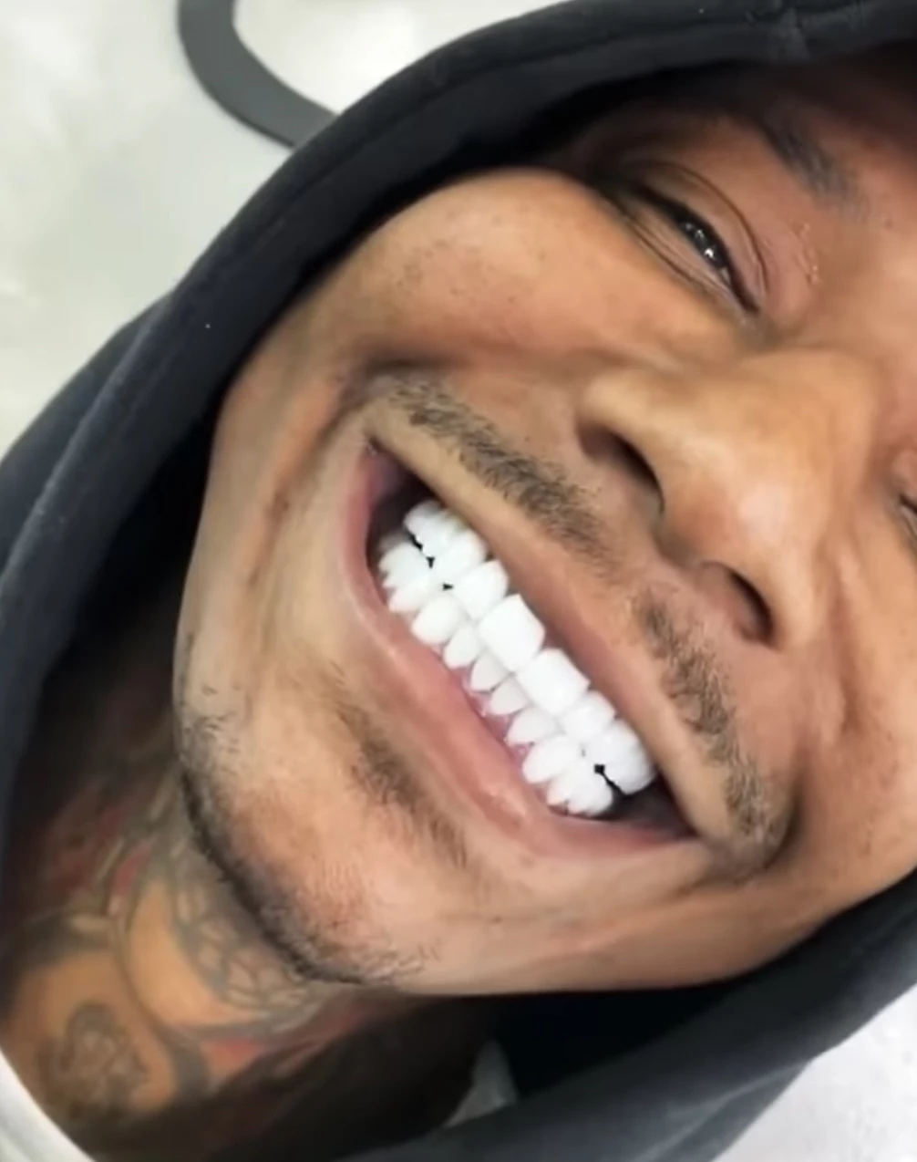 moneybagg-yo-white-teeth.jpg