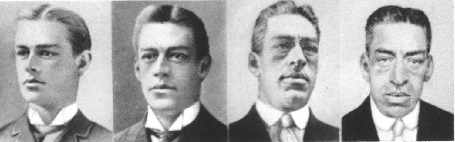 acromegaly.jpg