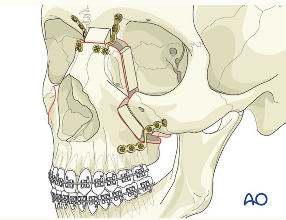 B5A30B58 9EC2 4906 A4EB BE25C8485E84
