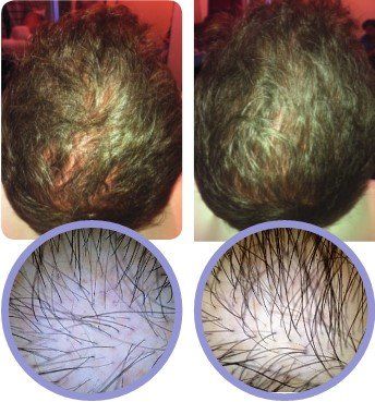 Before+and+After+%281%29-1920w.jpg