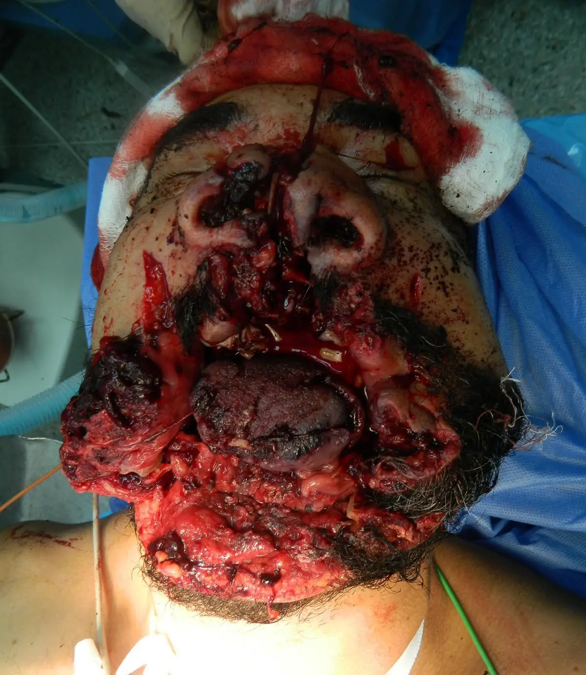 Unable to load image