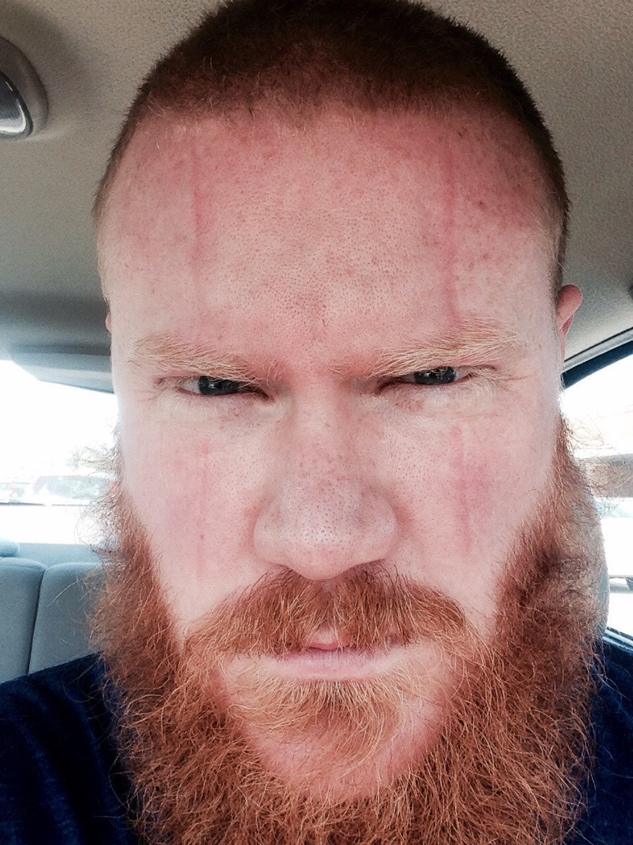 SQUINTMAXXING GUIDE | Looksmax.org - Men's Self-Improvement & Aesthetics