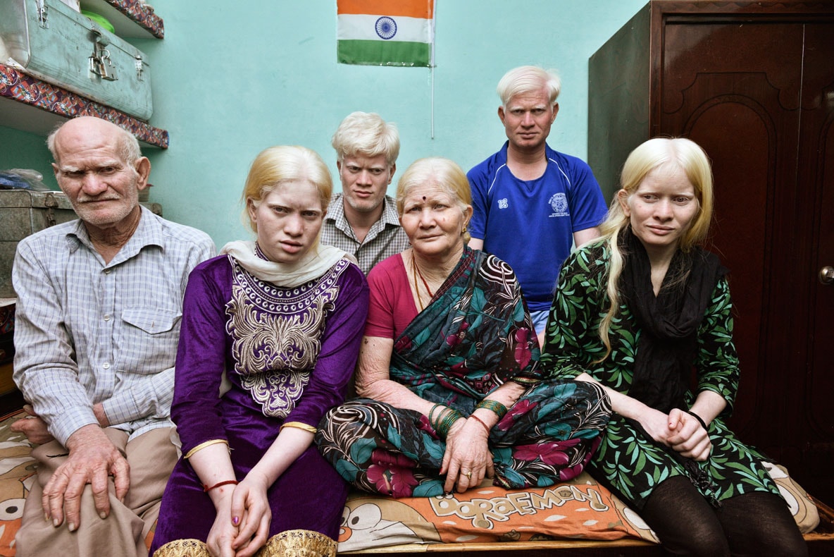 A Delhi family feels singled out for their skin | Hindustan Times