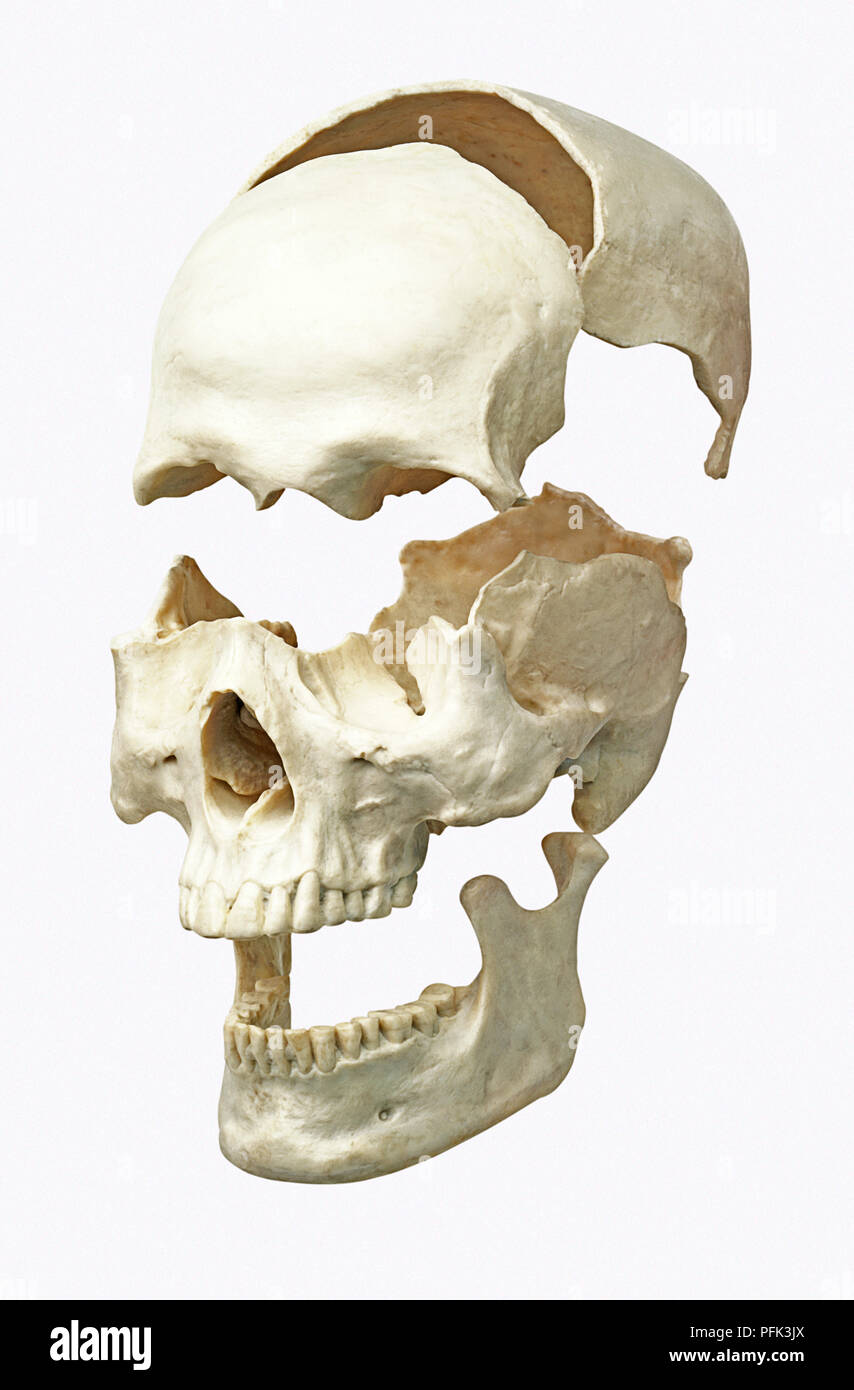 separated-parts-of-human-skull-PFK3JX.jpg