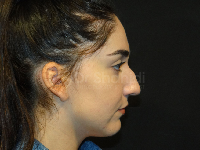190.1-before.jpg