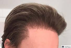 1781792027339