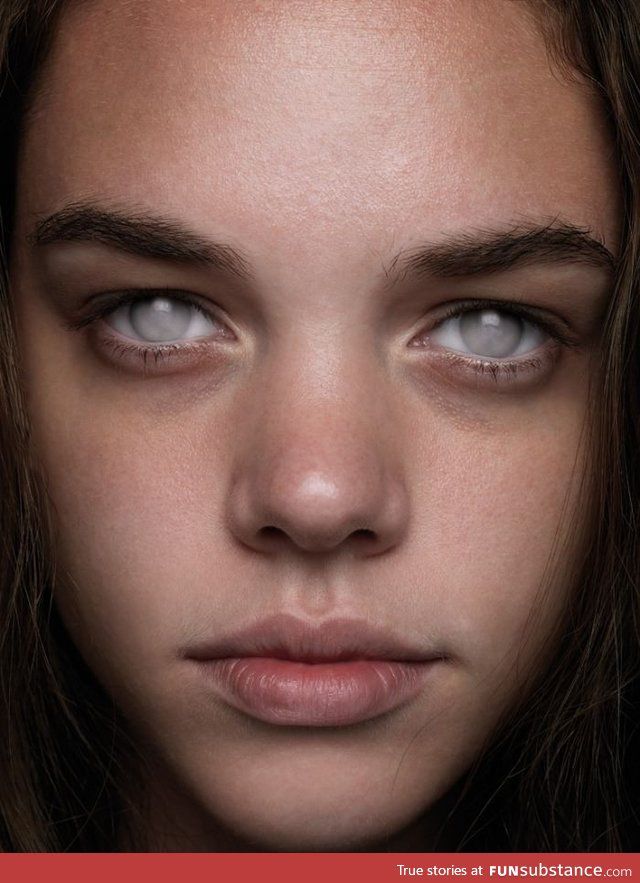 This is what blind eyes look like, mostly (when cause is not injury) -  FunSubstance
