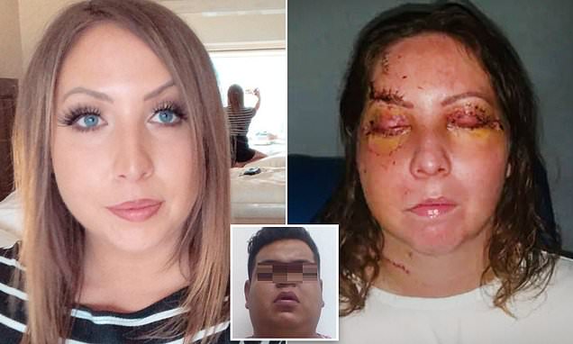 Flight attendant beaten unconscious in her Mexican hotel room