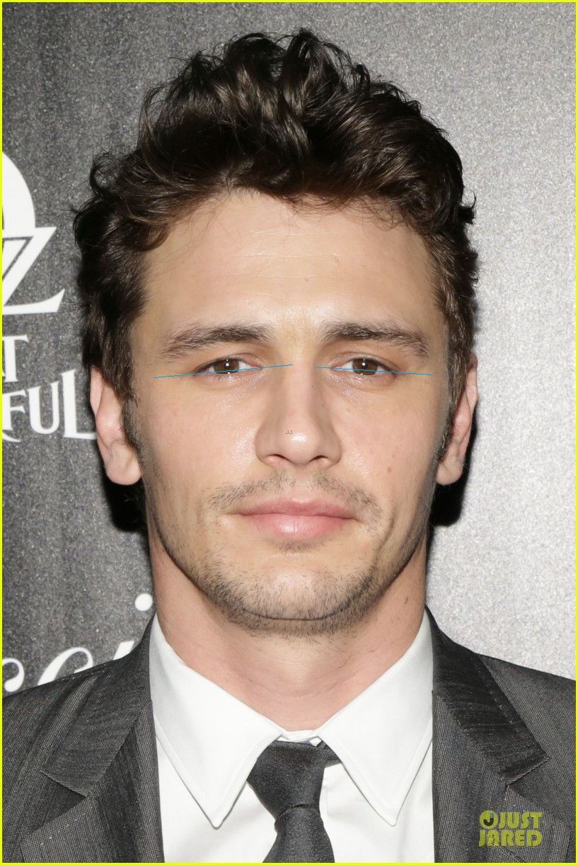 Negative canthal tilt (With images) | James franco