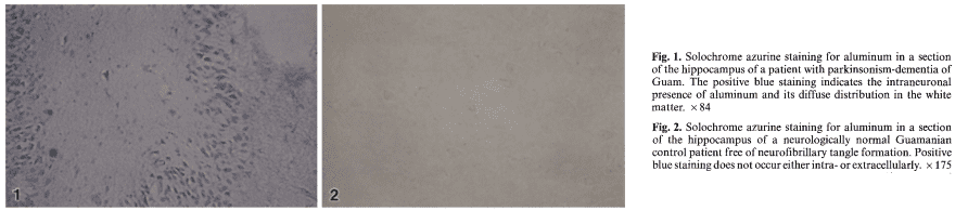 aluminum2.png