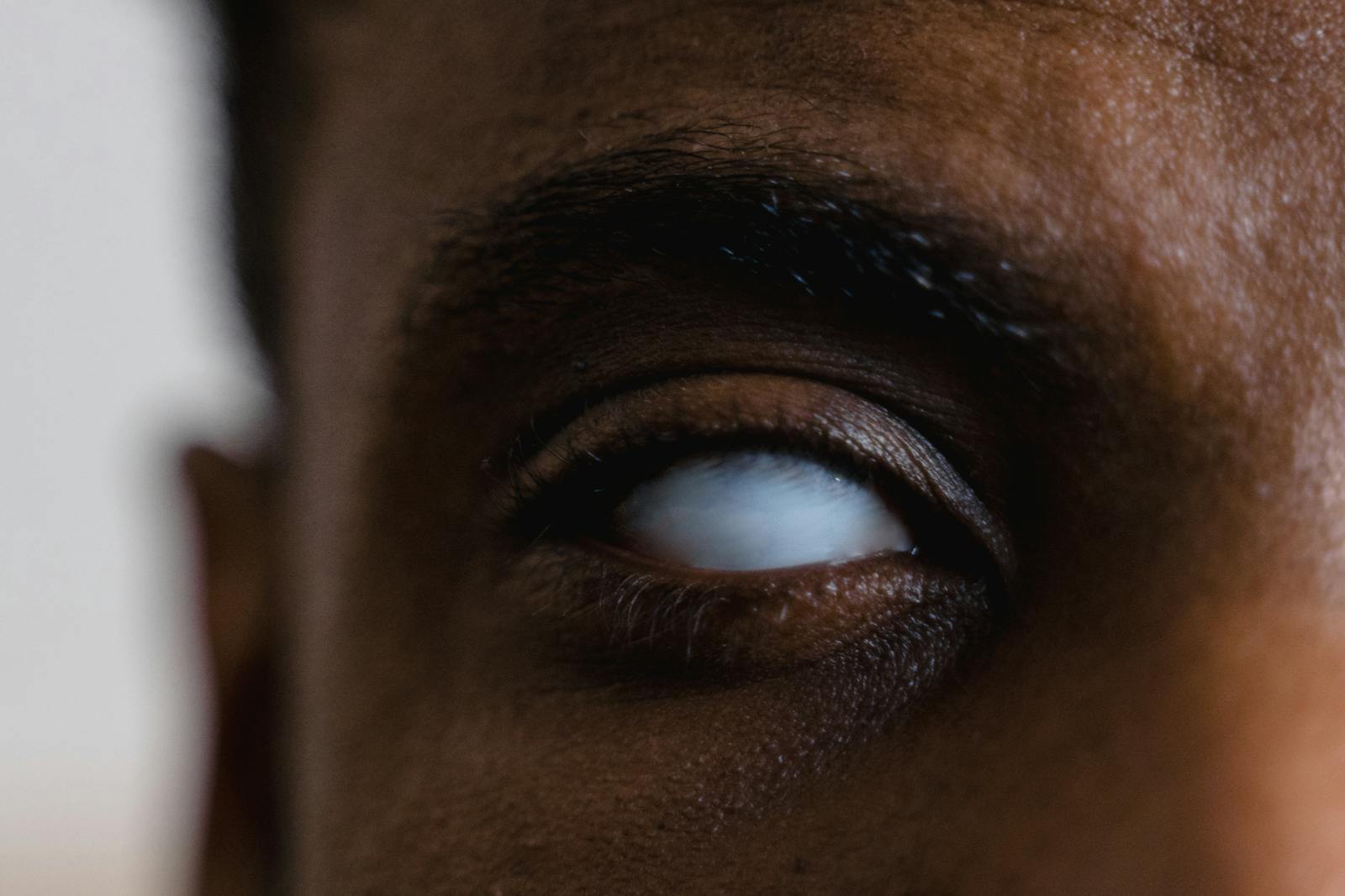 Why Does a Blind Eye Turn White?