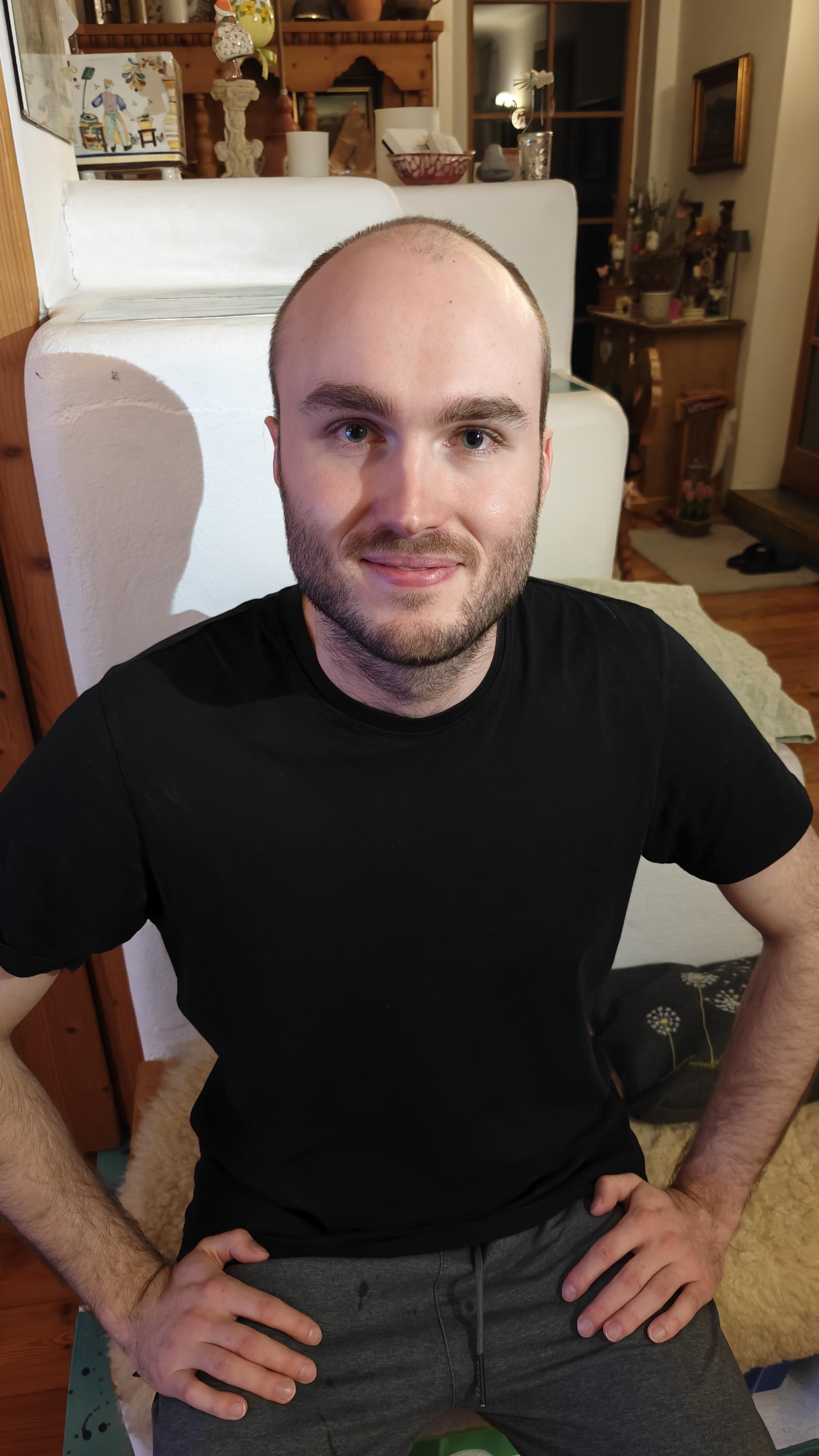 r/bald - UPDATE: I did it and I'm very happy