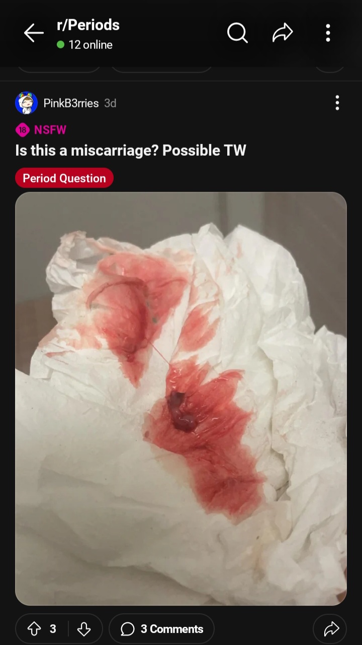 Screenshot 20240504 093928 Reddit